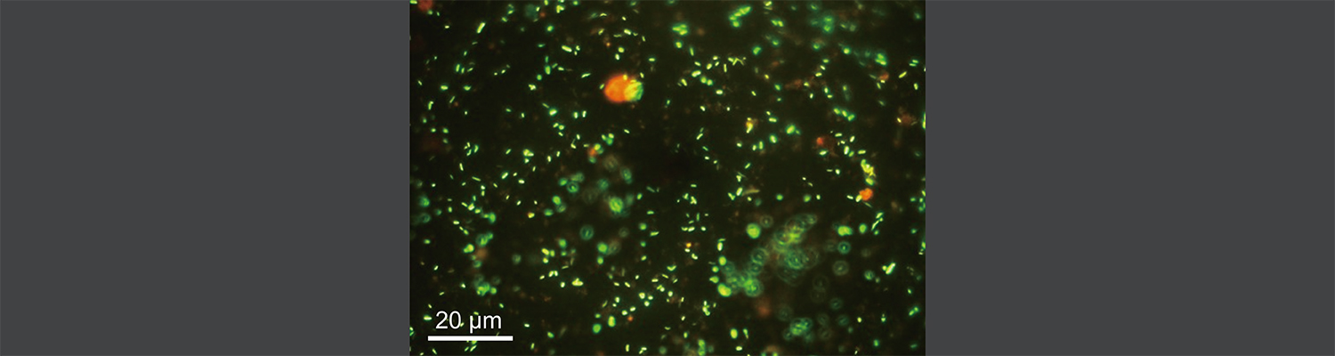 鉱物表面に分布する微生物の顕微鏡写真