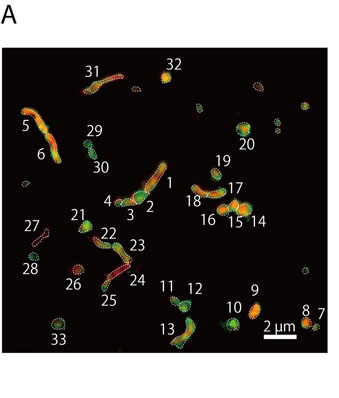 NanoSIMS分析結果から炭素安定同位体（13C）で標識されたグルコースの取り込みを赤色、窒素安定同位体（15N）で標識されたアンモニアの取り込みを緑で示す画像を作成し、重ね合わせたもの。